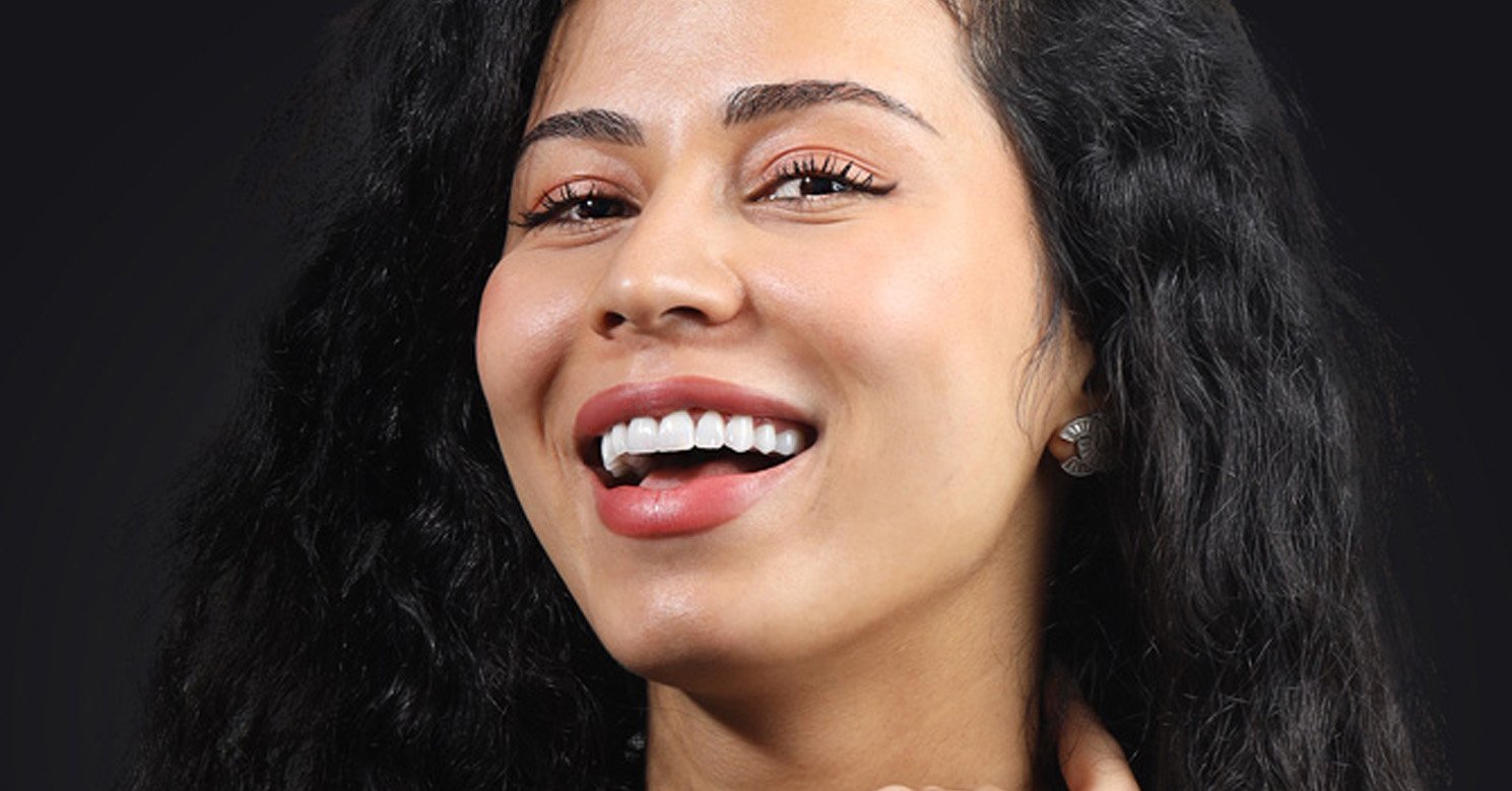 Hollywood Smile