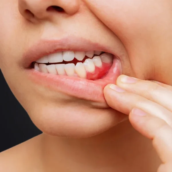 Periodontoloji_