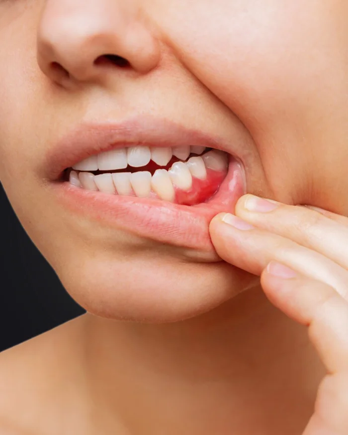 Periodontoloji_